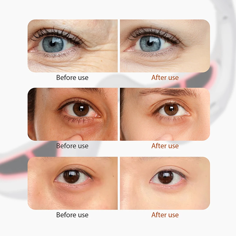 Before and after use of electric eye massage glasses device